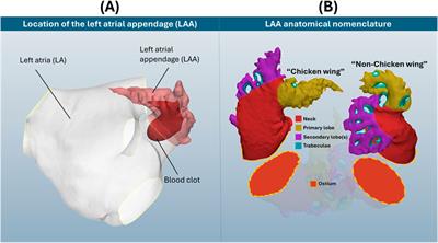 On preserving anatomical detail in statistical shape analysis for clustering: focus on left atrial appendage morphology